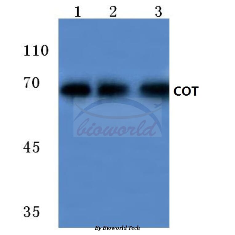 Anti-Cot (P284) Antibody from Bioworld Technology (BS1074) - Antibodies.com