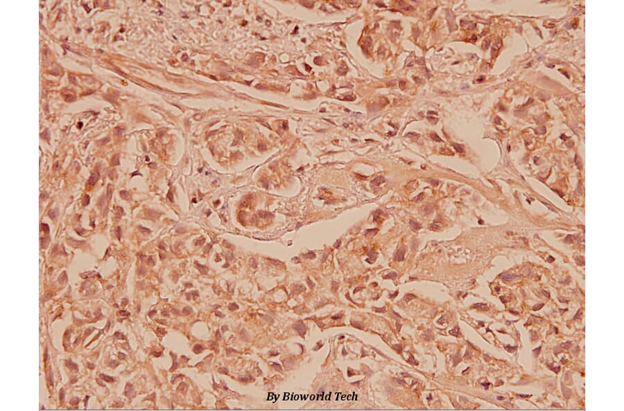 Anti-Cox-2 (T594) Antibody from Bioworld Technology (BS1076) - Antibodies.com