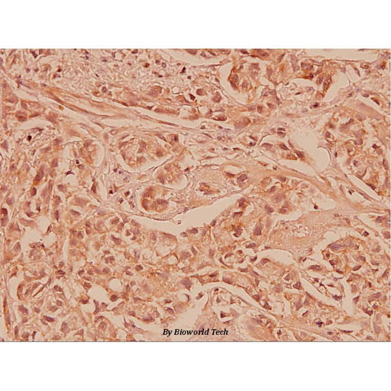 Anti-Cox-2 (T594) Antibody from Bioworld Technology (BS1076) - Antibodies.com