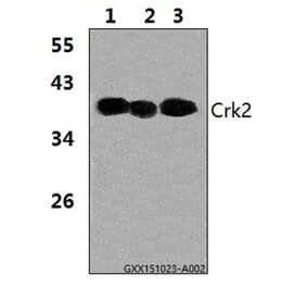 Anti-Crk2 (P215) Antibody from Bioworld Technology (BS1079) - Antibodies.com