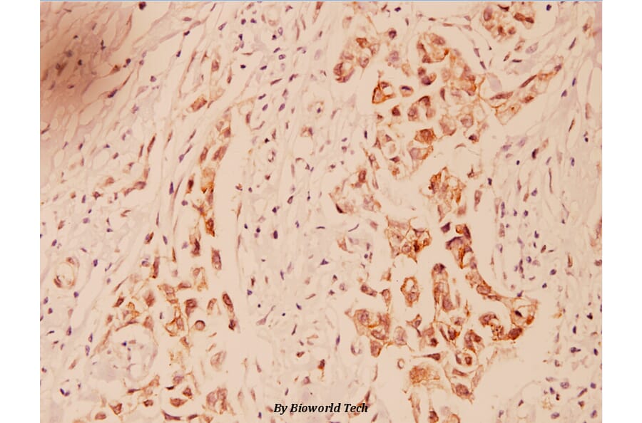 Anti-Crk2 (P215) Antibody from Bioworld Technology (BS1079) - Antibodies.com