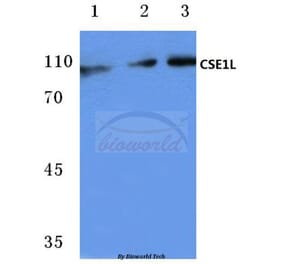 Anti-CSE1L (E2) Antibody from Bioworld Technology (BS1080) - Antibodies.com