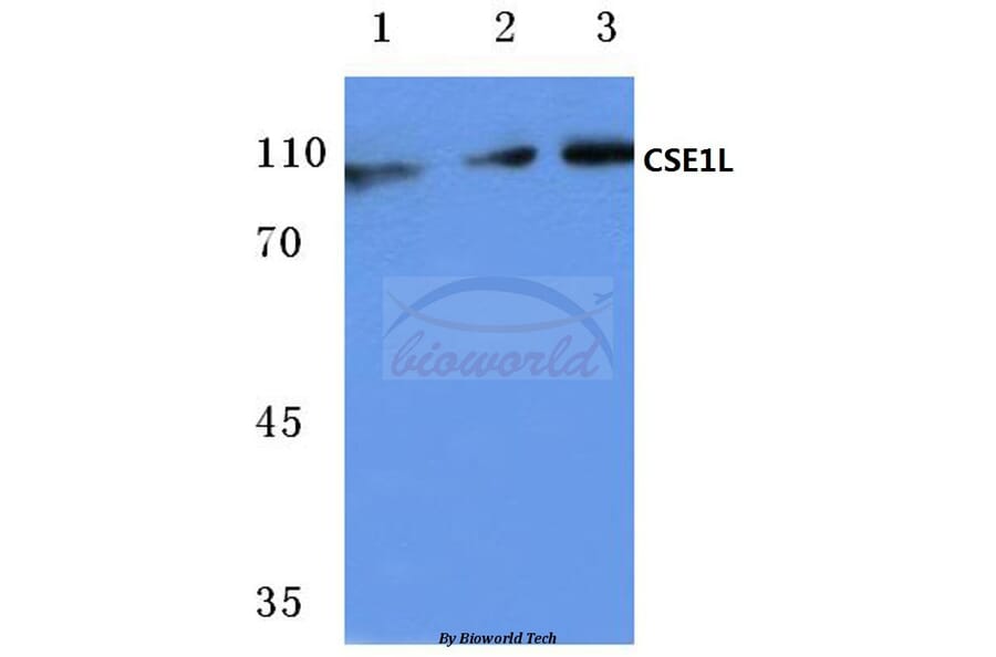 Anti-CSE1L (E2) Antibody from Bioworld Technology (BS1080) - Antibodies.com