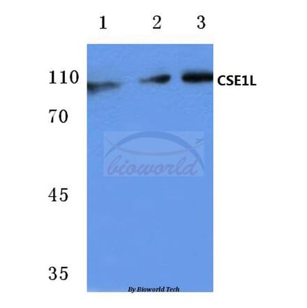 Anti-CSE1L (E2) Antibody from Bioworld Technology (BS1080) - Antibodies.com