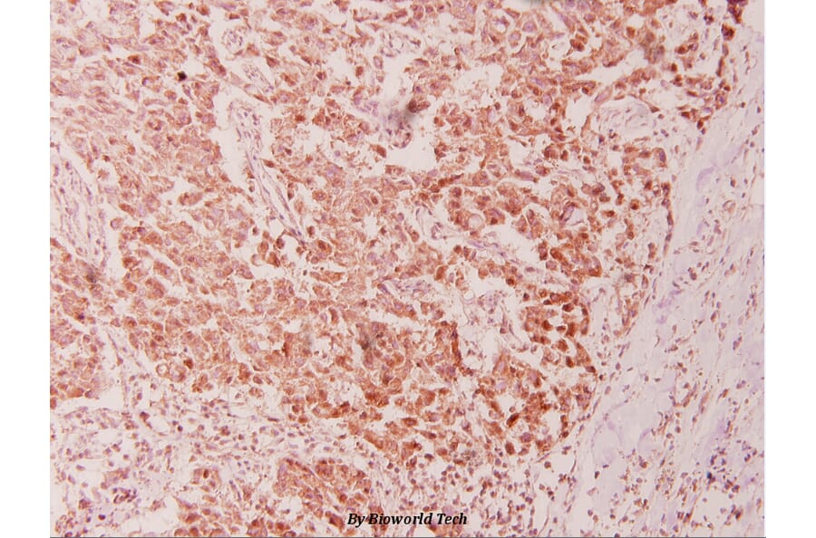 Anti-CSE1L (E2) Antibody from Bioworld Technology (BS1080) - Antibodies.com