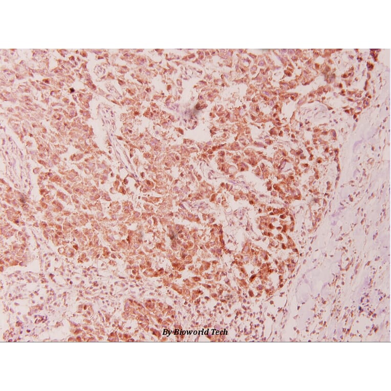 Anti-CSE1L (E2) Antibody from Bioworld Technology (BS1080) - Antibodies.com