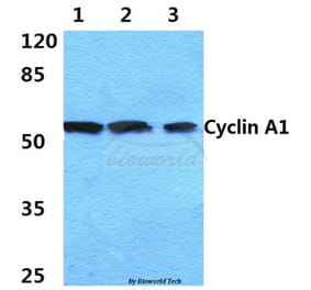 Anti-Cyclin A1 (R436) Antibody from Bioworld Technology (BS1084) - Antibodies.com