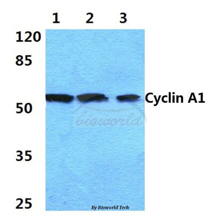 Anti-Cyclin A1 (R436) Antibody from Bioworld Technology (BS1084) - Antibodies.com