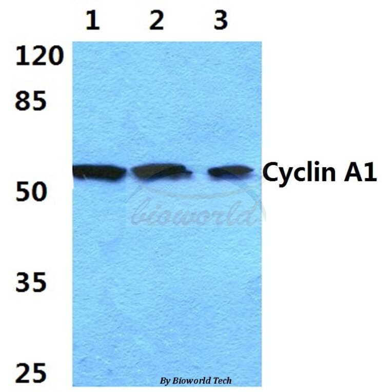 Anti-Cyclin A1 (R436) Antibody from Bioworld Technology (BS1084) - Antibodies.com
