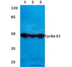 Anti-Cyclin E1 (I119) Antibody from Bioworld Technology (BS1085) - Antibodies.com