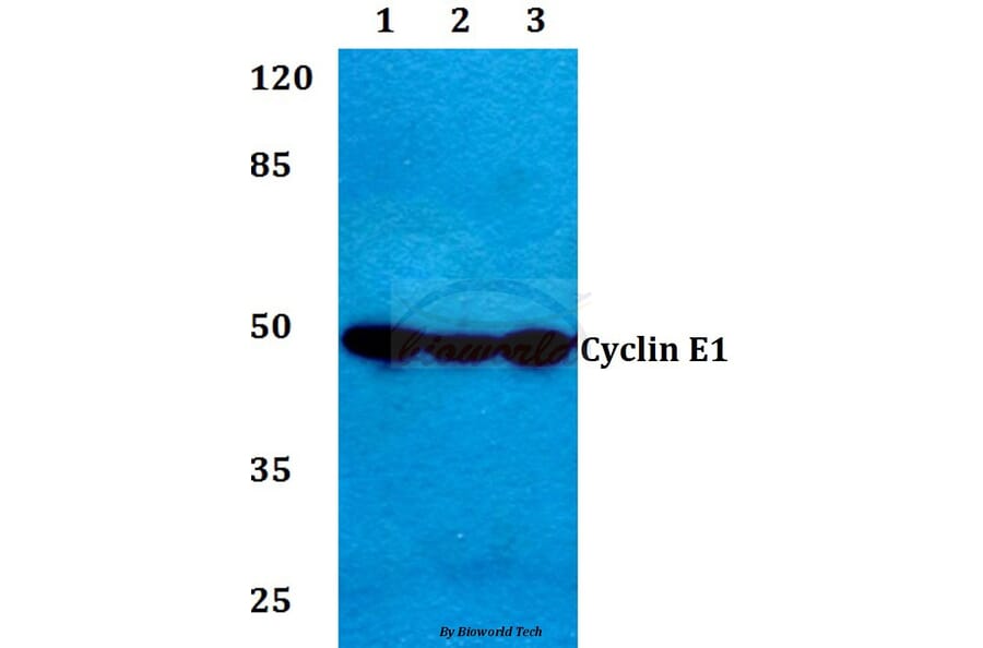 Anti-Cyclin E1 (I119) Antibody from Bioworld Technology (BS1085) - Antibodies.com