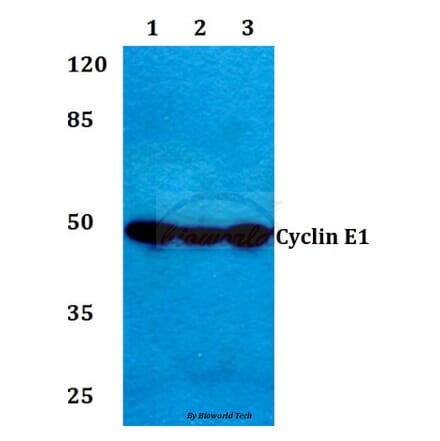 Anti-Cyclin E1 (I119) Antibody from Bioworld Technology (BS1085) - Antibodies.com