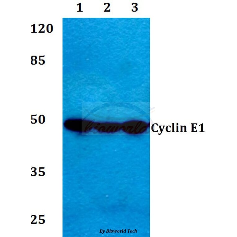 Anti-Cyclin E1 (I119) Antibody from Bioworld Technology (BS1085) - Antibodies.com