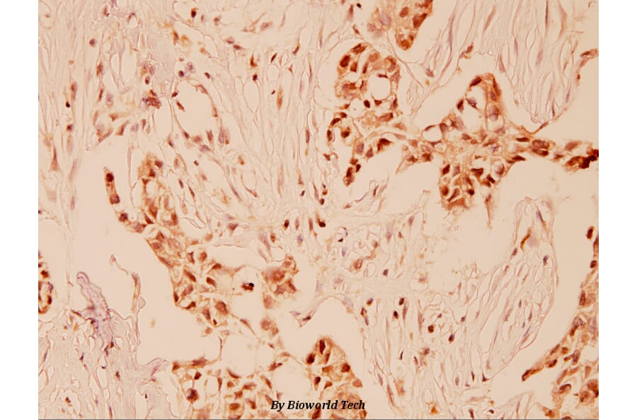 Anti-Cyclin E1 (I119) Antibody from Bioworld Technology (BS1085) - Antibodies.com