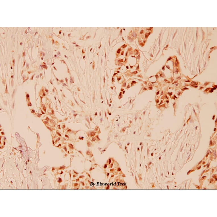 Anti-Cyclin E1 (I119) Antibody from Bioworld Technology (BS1085) - Antibodies.com