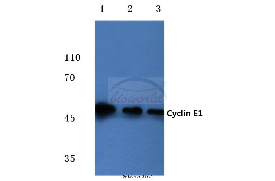 Anti-Cyclin E1 (L389) Antibody from Bioworld Technology (BS1086) - Antibodies.com