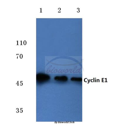 Anti-Cyclin E1 (L389) Antibody from Bioworld Technology (BS1086) - Antibodies.com
