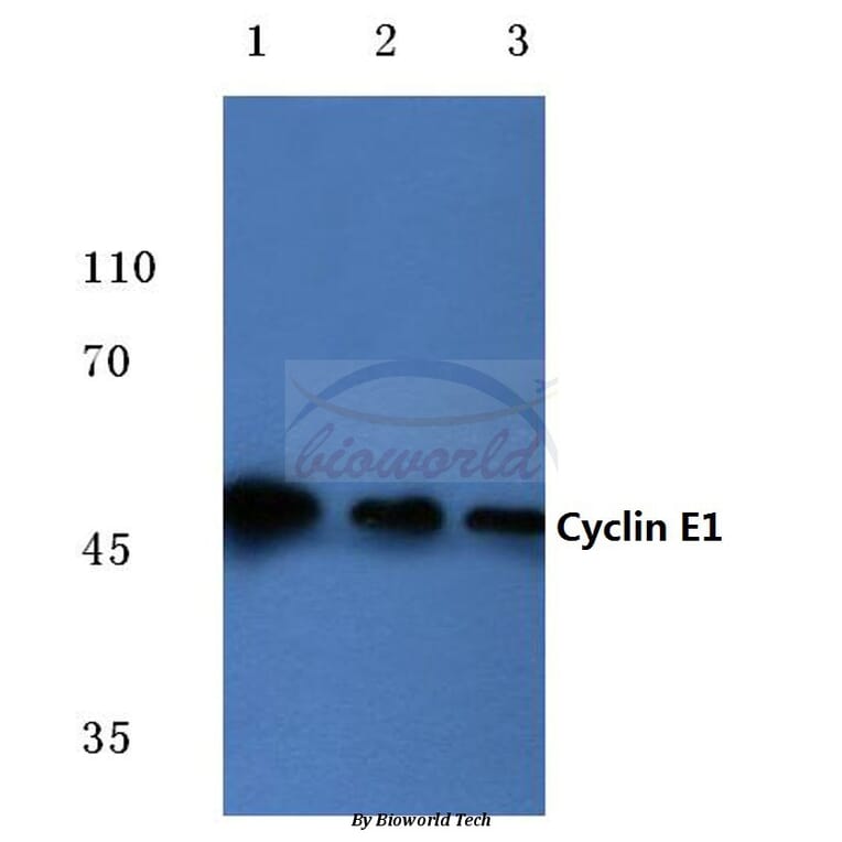 Anti-Cyclin E1 (L389) Antibody from Bioworld Technology (BS1086) - Antibodies.com