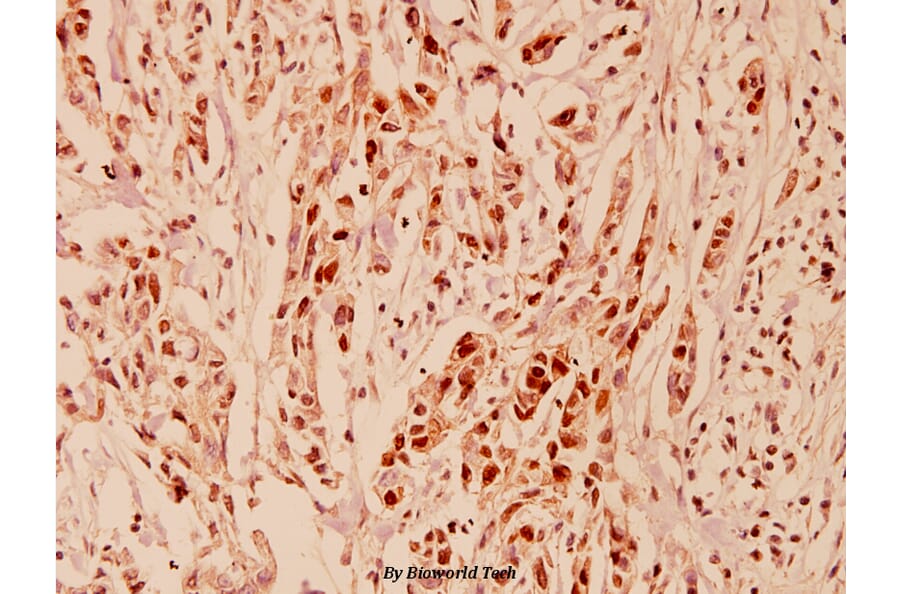 Anti-Cyclin E1 (L389) Antibody from Bioworld Technology (BS1086) - Antibodies.com