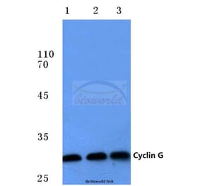 Anti-Cyclin G (I194) Antibody from Bioworld Technology (BS1088) - Antibodies.com