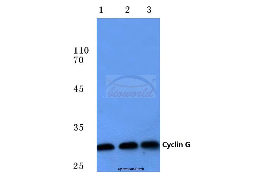 Anti-Cyclin G (I194) Antibody from Bioworld Technology (BS1088) - Antibodies.com