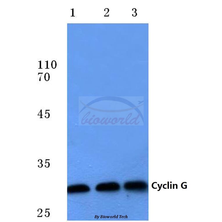 Anti-Cyclin G (I194) Antibody from Bioworld Technology (BS1088) - Antibodies.com
