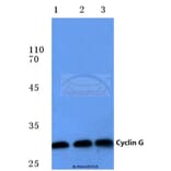Anti-Cyclin G (I194) Antibody from Bioworld Technology (BS1088) - Antibodies.com