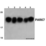 Anti-PARK7 (P54) Antibody from Bioworld Technology (BS1090) - Antibodies.com