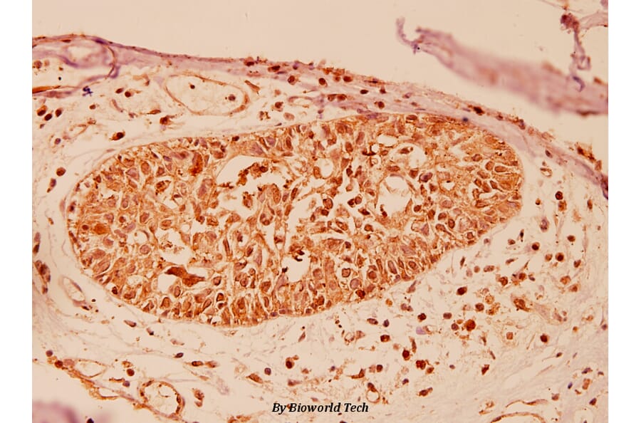 Anti-PARK7 (P54) Antibody from Bioworld Technology (BS1090) - Antibodies.com