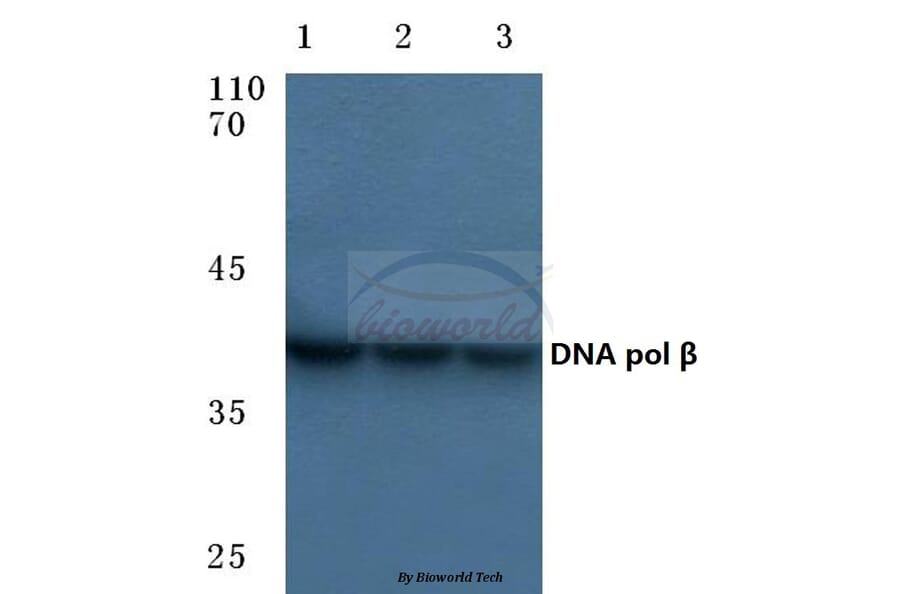 Anti-DNA pol β (Q324) Antibody from Bioworld Technology (BS1091) - Antibodies.com