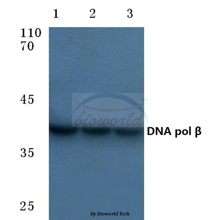 Anti-DNA pol β (Q324) Antibody from Bioworld Technology (BS1091) - Antibodies.com