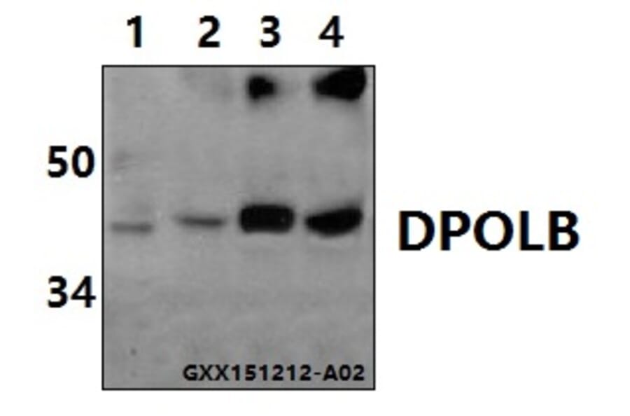 Anti-DNA pol β (Q324) Antibody from Bioworld Technology (BS1091) - Antibodies.com