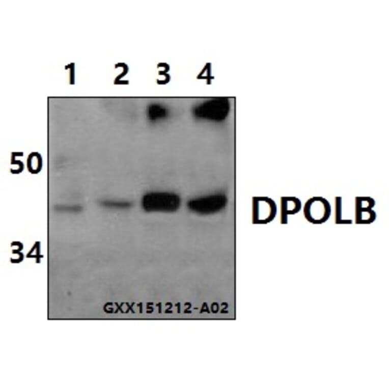 Anti-DNA pol β (Q324) Antibody from Bioworld Technology (BS1091) - Antibodies.com