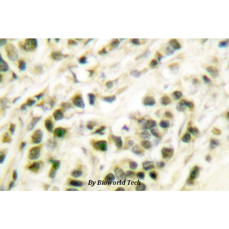 Anti-DNA pol β (Q324) Antibody from Bioworld Technology (BS1091) - Antibodies.com