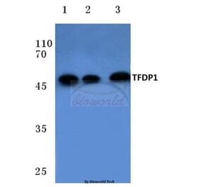 Anti-TFDP1 (V393) Antibody from Bioworld Technology (BS1093) - Antibodies.com