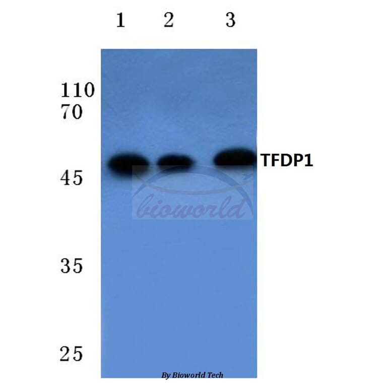 Anti-TFDP1 (V393) Antibody from Bioworld Technology (BS1093) - Antibodies.com