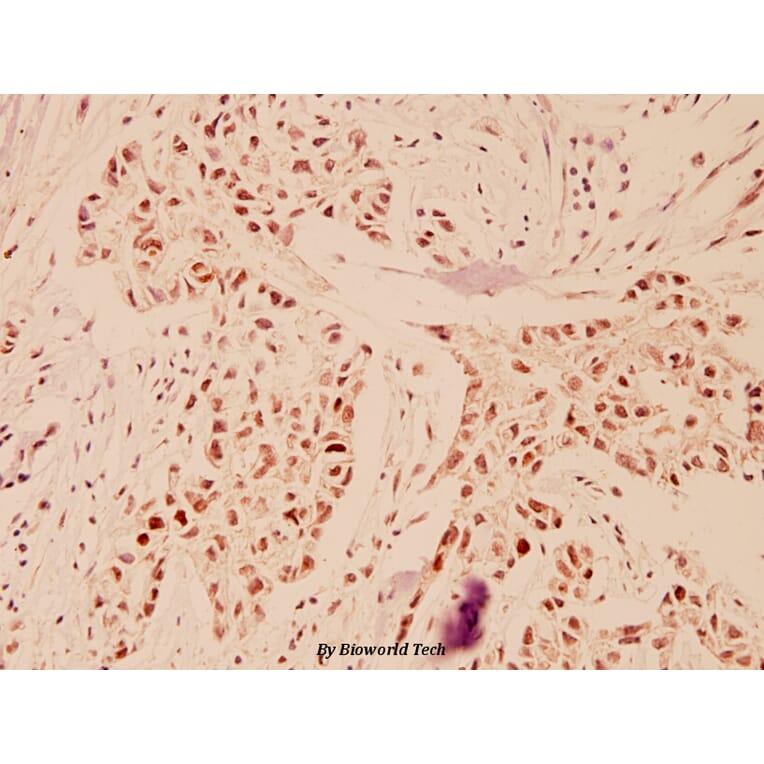 Anti-TFDP1 (V393) Antibody from Bioworld Technology (BS1093) - Antibodies.com