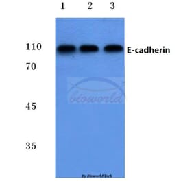 Anti-E-cadherin (G2) Antibody from Bioworld Technology (BS1097) - Antibodies.com