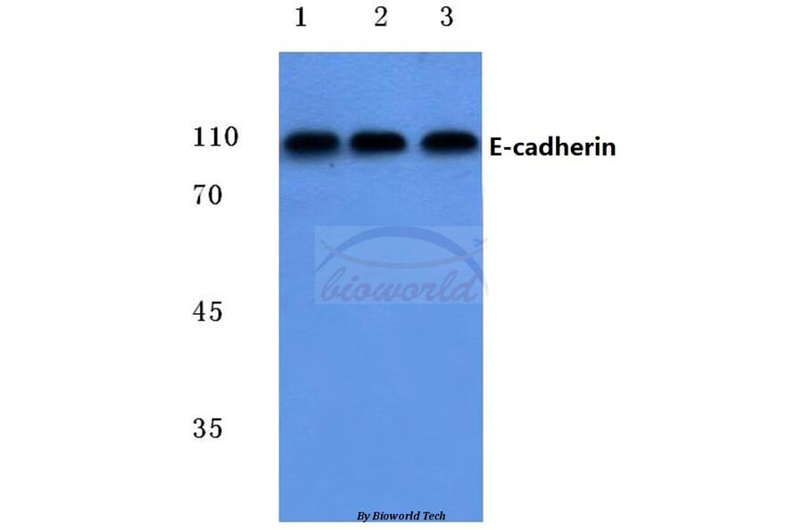 Anti-E-cadherin (G2) Antibody from Bioworld Technology (BS1097) - Antibodies.com