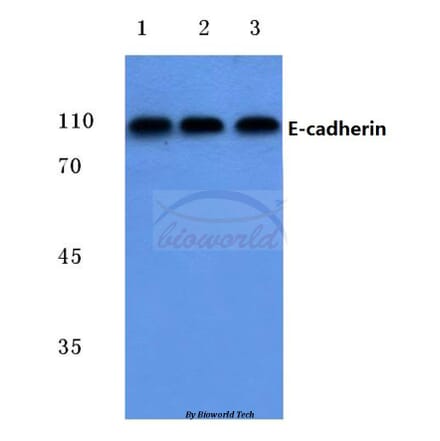Anti-E-cadherin (G2) Antibody from Bioworld Technology (BS1097) - Antibodies.com
