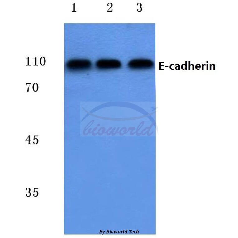 Anti-E-cadherin (G2) Antibody from Bioworld Technology (BS1097) - Antibodies.com