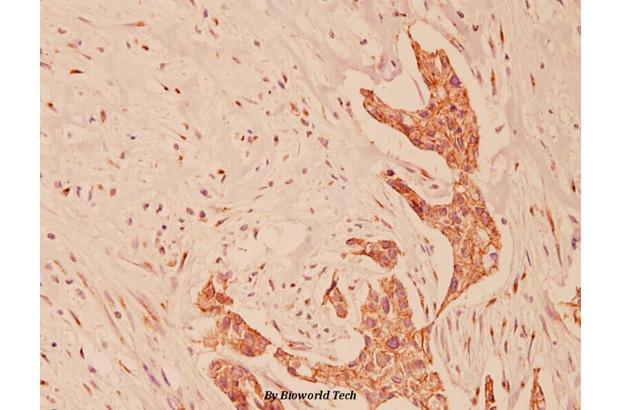 Anti-E-cadherin (G2) Antibody from Bioworld Technology (BS1097) - Antibodies.com
