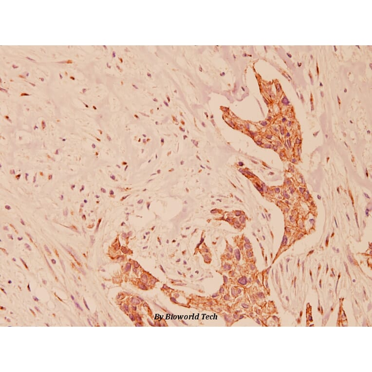 Anti-E-cadherin (G2) Antibody from Bioworld Technology (BS1097) - Antibodies.com