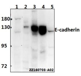 Anti-E-cadherin (R868) Antibody from Bioworld Technology (BS1098) - Antibodies.com