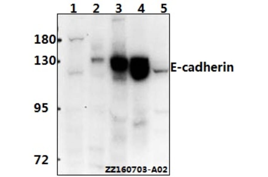 Anti-E-cadherin (R868) Antibody from Bioworld Technology (BS1098) - Antibodies.com