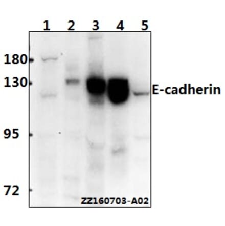 Anti-E-cadherin (R868) Antibody from Bioworld Technology (BS1098) - Antibodies.com