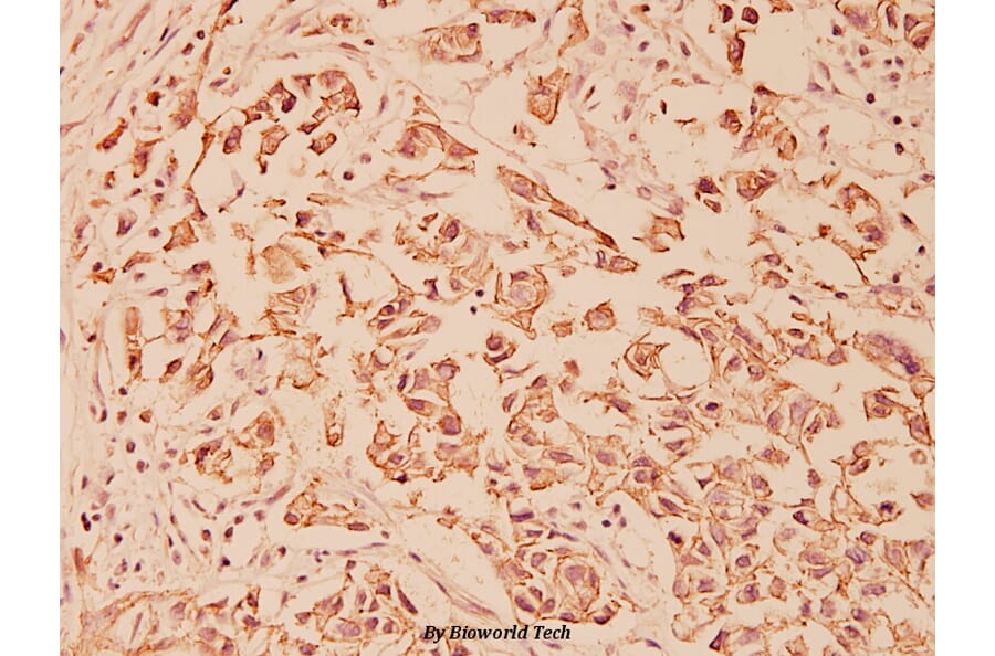 Anti-E-cadherin (R868) Antibody from Bioworld Technology (BS1098) - Antibodies.com