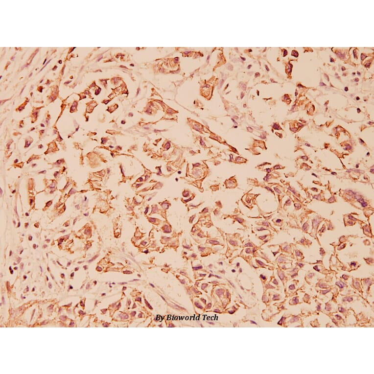 Anti-E-cadherin (R868) Antibody from Bioworld Technology (BS1098) - Antibodies.com