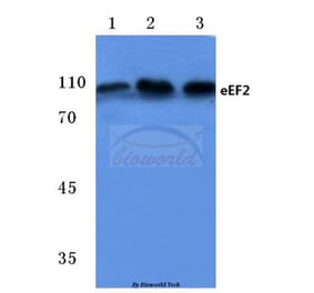 Anti-EEF2 (A50) Antibody from Bioworld Technology (BS1099) - Antibodies.com