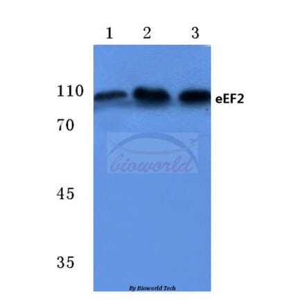 Anti-EEF2 (A50) Antibody from Bioworld Technology (BS1099) - Antibodies.com